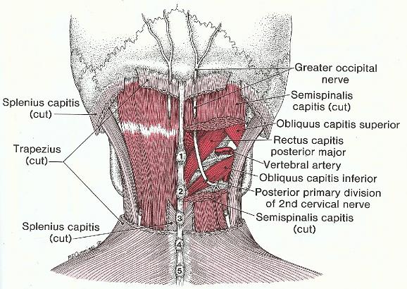 Nackutlöst huvudvärk - Stora Occipitalnerven